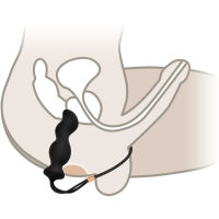 ANÁLNÍ KOLÍK SE SMYČKOU ANAL PLUG KE STIMULACI PROSTATY SE SVORKOU NA VARLATA A PENIS  - 73559087 - 3