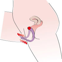 STIMULÁTOR G-BODU - ROZŠIŘUJE DÍRKU - DSR 0503517 - 6